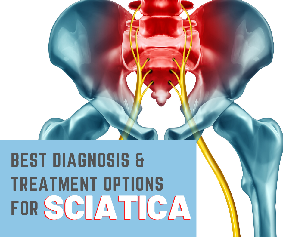 Sciatica Symptoms, Diagnosis & Treatment